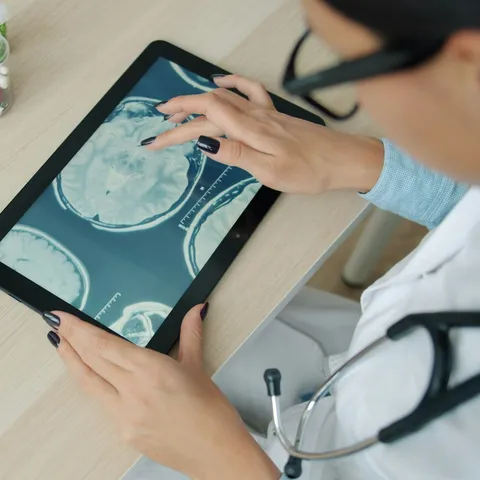 A doctor reviewing a brain scan on a tablet beside a laptop